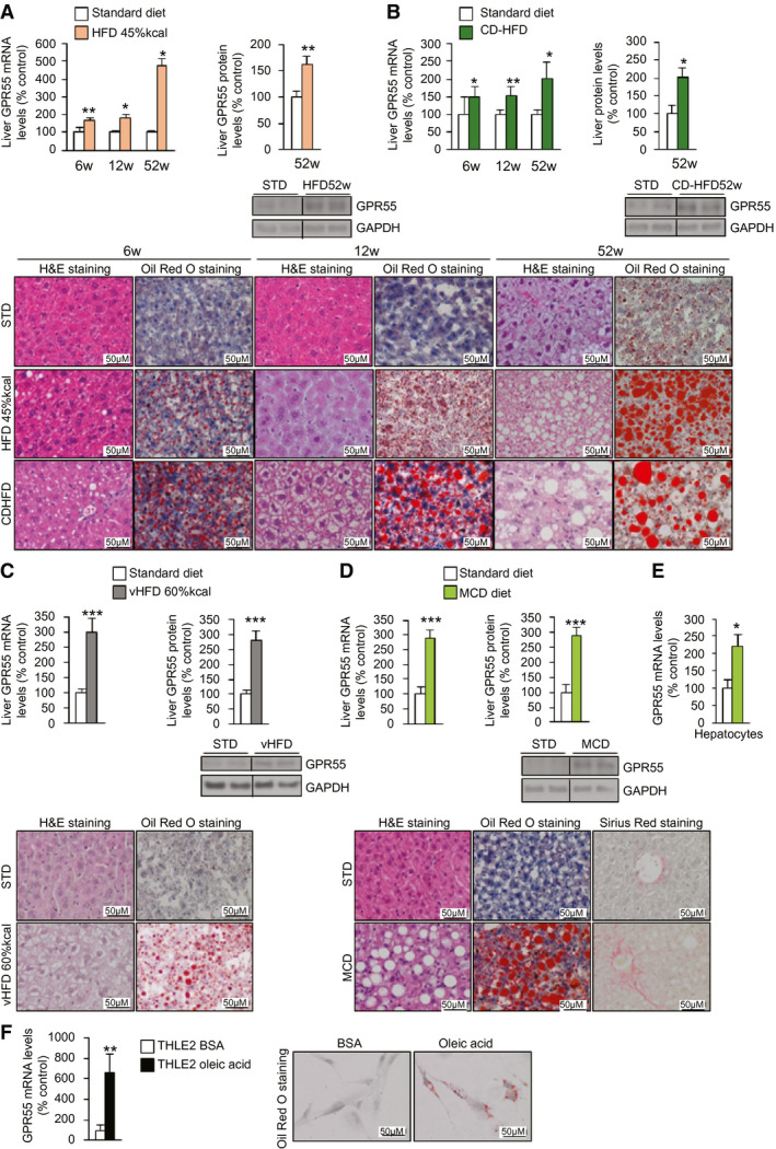 Hepatic GPR55 is increased in different models of NAFLD in vivo and in vitro. GPR55 mRNA levels, GPR55 protein levels, H&E staining, and Sirius Red staining in the liver of (A) mice fed an HFD with 45%‐kcal fat content or an STD for 6, 12, and 52 weeks (n = 5‐14); (B) mice fed a CD‐HFD or STD for 6, 12, and 52 weeks (n = 5‐10); (C) mice fed a vHFD with 60%‐kcal fat content or an STD for 10 weeks (n = 9‐10); and (D) mice fed an MCD diet or an STD for 4 weeks (n = 7‐10 per group). (E) GPR55 mRNA levels in hepatocytes isolated from the liver of mice fed an MCD diet or STD for 4 weeks (n = 5 per group). (F) GPR55 mRNA levels in THLE2 cells cultured in oleic acid or BSA (n = 6). GAPDH and HPRT were used to normalize protein and mRNA levels. Dividing lines indicate splicing in the same gel. Data are presented as mean ± SEM. Statistical differences are denoted by *P < 0.05, **P < 0.01, and ***P < 0.001. Abbreviations: BSA, bovine serum albumin; CD‐HFD, choline‐deficient HFD; GAPDH, glyceraldehyde 3‐phosphate dehydrogenase; GPR55, G protein–coupled receptor 55; H&E, hematoxylin and eosin; HFD, high‐fat diet; HPRT, hypoxanthine‐guanine phosphoribosyltransferase; MCD, methionine‐choline–deficient; NAFLD, nonalcoholic fatty liver disease; STD, standard diet; vHFD, very HFD.