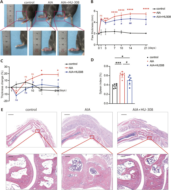 CB2 specific agonist HU-308 ameliorates adjuvant-induced arthritis (AIA) (A) Representative photographs of the paws from indicated mice. (B) The variation tendency of paw thickness across the different treatment groups. (C) Changes in paw thickness relative to the first day. (D) Spleen index (defined as the ratio of spleen mass to body mass) for each group of mice. (E) Representative histological images of hematoxylin and eosin (H&E) staining for the paws. (Horizontal scale bars = 1 mm in the lower magnification images; 100 µm in the higher magnification images). All data represent the mean ± SD, n = 5. Significance between every two groups was calculated using unpaired two-tailed Student’s t-test. *p < 0.05, ***p < 0.001 and ****p < 0.0001 compared to control group; #p < 0.05, ##p < 0.01 compared to AIA group. ns, not significant.