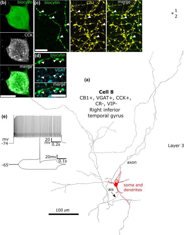 A CB1/VGAT/CCK‐immunopositive neuron recorded in vitro and labelled by biocytin in layer 3. (a). Reconstruction of the recovered parts of the cell (cell 8 in Figure 8f) with soma and dendrites (red) and a low‐density loose axon. (b) The soma of the cell (green) showed granular immunoreactivity for CCK in the cytoplasm. (c) The biocytin‐labelled axon (green) and boutons were CB1‐positive (e.g. arrowheads). (d) The boutons (green, arrowheads) show immunoreactivity for VGAT (blue). Max intensity projections of optical slices in Z stack, total depth: (b), 10.5 μm; (c), 3 μm; (d), 0.35 μm. (e) Voltage responses of the cell to current injections of rheobase (400 ms duration), RB + 100 pA (upper trace, 1 s duration), and holding current −100 pA; no voltage sag was detected to the hyperpolarising current injection. The cell fired regularly with moderate spike frequency adaptation and an initial spike amplitude accommodation when continuously depolarised. Scale bars: (b, c) 10 μm; (d) 5 μm.