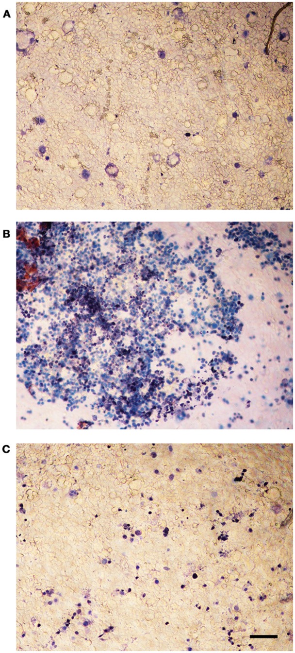 Trypan blue assay on Caco-2 monolayers infected with L. monocytogenes grown in presence of the C. sativa EO. (A) uninfected control; (B) monolayers infected with L. monocytogenes #80466 not incubated with the EO; (C) monolayers infected with L. monocytogenes #80466 grown in presence of 256 μg/mL of the EO (magnification: 100 ×; bar, 400 μm).