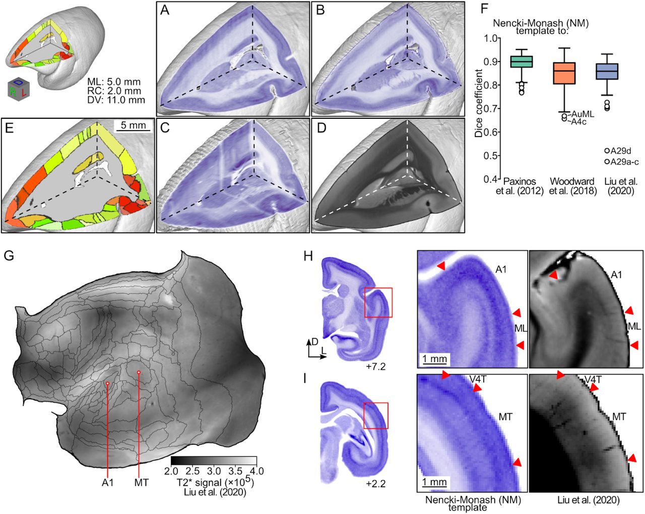 Atlas interoperability.A-D: Cross-sectional views of 3D reconstructions of the marmoset dorsolateral prefrontal cortex, comparing the histological appearance of this part of the brain in the NM template (A, present data), the Brain/MINDS marmoset brain atlas (B; Woodward et al., 2018), a volumetric reconstruction of the Paxinos et al., (2012) atlas (C; Majka et al., 2016), and the MBM atlas 2.0 (D; Liu et al., 2020). A-C are based on Nissl stain, and D on ex-vivo MRI (T2* contrast). The subdivision of the cortex into areas is illustrated in panel E, according to the present template. F: Registration accuracy expressed with the Dice coefficient. The box plots (centerline: median; box limits: upper and lower quartiles; whiskers: 1.5 × interquartile range; points: outliers) represent distributions of the values of the overlap between pairs of corresponding areas. G: T2* signal reported by Liu et al., (2020) registered to the NM template, presented using the flat map representation of the cortex. H, I: Comparisons of sections through the dorsal temporal lobe demonstrate the good correspondence between the borders of areas in the Nissl intensity image (middle panels, present data) and the coregistered T2* MRI (right panels, from the MBM 2.0 atlas). For a list of areas and their abbreviations see Table S2.