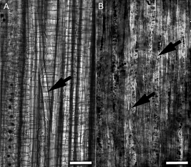 Structure of the (A) primary and (B) secondary phloem fibre bundles on the strips peeled off from the third internode of a 117-day-old plant hemp stem. Bundles frequently split and merge along the stem forming numerous anastomoses (marked by arrows). Bar = 100 µm.