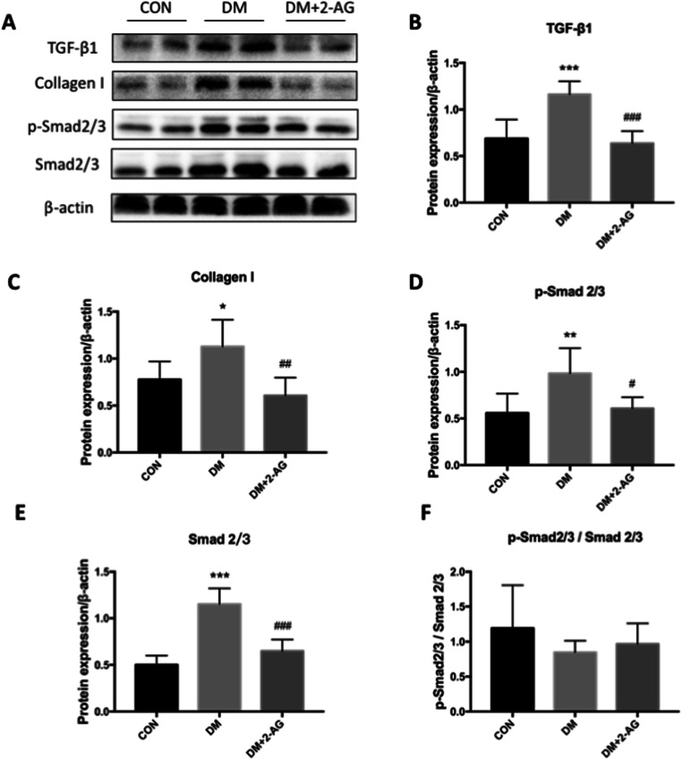 2-AG inhibits activation of the TGF-β1/Smad signaling pathway in myocardial fibrosis A. Western blot of TGF-β1, collagen I, p-Smad2/3, Smad2/3, and β-actin. B, C, D, and E are statistical representations of the relative expression of TGF-β1, collagen I, p-Smad2/3, and Smad2/3, respectively. F is the ratio of p-Smad2/3 and Smad2/3. *P < 0.05, **P < 0.01, ***P < 0.001 compared with the CON group; #P < 0.05, ##P < 0.01, ###P < 0.001, compared with the DM group. n = 3