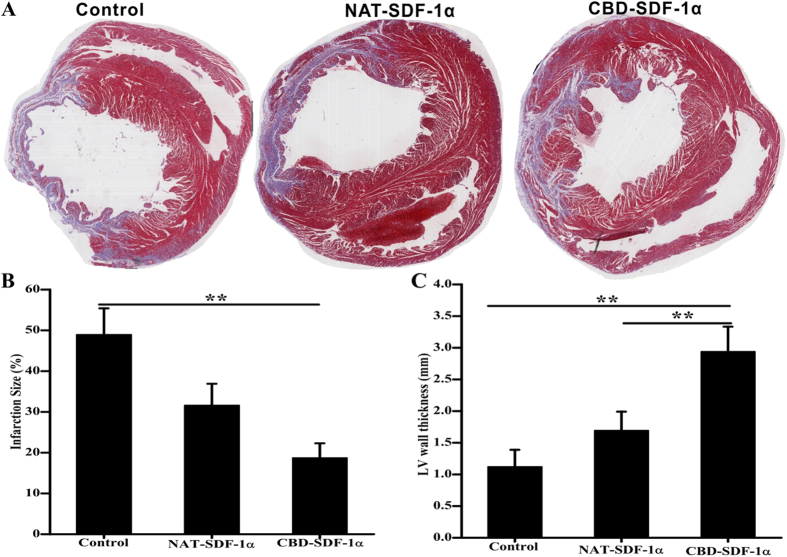 Measurement of infarct size and LV wall thickness.(A) Representative images of Masson’s trichrome staining. (B) The proportion of scar tissues (blue) in the left ventricle was determined by calculating the ratio of the area of scar to the left ventricular area (n = 8 in each group). (C) Average thickness of the LV wall in the infarcted region (n = 8 in each group). CBD-SDF-1α reduced the infarct size and increased the LV wall thickness. The data are presented as the means ± SEM, **P < 0.01.