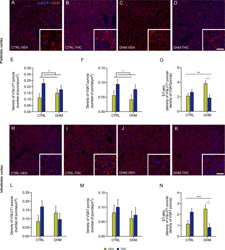 Analysis of markers of excitatory and inhibitory neurotransmission in prelimbic and infralimbic cortices.a–d Representative confocal images of excitatory (red, VGLUT1) and inhibitory (blue, VGAT) puncta in the neuropil of prelimbic cortex of CTRL and DHM animals after administration (VEH or THC). Scale bar: 10 and 3.3 μm for the detail. Graphs representing the density of VGLUT1 (e) and VGAT (f) immunoreactive puncta, and the E/I ratio [number of VGLUT1+ puncta/μm2]/[number of VGAT+ puncta/μm2] (g). e, f graphs show differences in VGLUT and VGAT expression due to THC administration after two-way ANOVA analysis. Horizontal lines in G represent interaction (black, dashed) after two-way ANOVA. Gray symbols and lines in graphs represent statistically significant differences among groups after post hoc. h–k Representative confocal images of excitatory (red, VGLUT1) and inhibitory (blue, VGAT) puncta in the neuropil of Infralimbic cortex of CTRL and DHM animals after administration (VEH or THC). Scale bar: 10 μm and 3.3 μm for the detail. Graphs representing the density of VGLUT1 (l) and VGAT (m) immunoreactive puncta, and the E/I ratio (n). Graphs show differences in the E/I ratio due to the interaction between model and administration after two-way ANOVA analysis p < 0.05 (*), p < 0.01 (**), p < 0.001 (***). Bars represent the mean ± S.E.M. n = 6 animals/group.