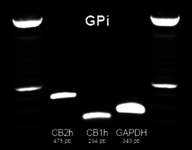Detection by PCR amplification of CB1R and CB2R mRNA transcripts in the GPi. GAPDH mRNA was used as a positive control