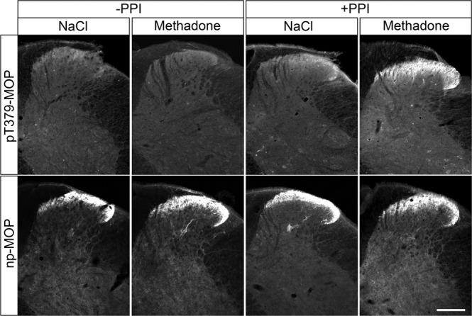 Comparison of phospho-MOP immunohistochemistry in the presence or absence of protein phosphatase inhibitors.Animals were either treated with methadone or saline for 30 min, transcardially perfused, fixed and stained in the presence (+) or absence (-) of protein phosphatase inhibitors (PPI). Shown are confocal images of coronal sections of the spinal cord stained with pT379-MOP or np-MOP antibody. Note that PPIs need to be present during both fixation and staining procedures to obtain agonist-induced phospho-MOP immunostaining. Scale bar = 250 µm.