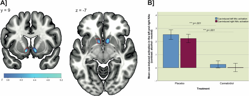 Treatment effect on cue-induced activation in the left and right NAc.Depiction of A the activation clusters in the left and right nucleus accumbens (NAc), which showed a significant treatment effect with significantly lower cue-induced activation in the CBD group (n = 12) compared to the PLC group (n = 13) (pFWE < 0.05 small volume corrected for the NAc as pre-specified region of interest; boundaries of the region of interest mask are plotted as red and blue lines) and B the significant difference in mean alcohol cue-induced brain activation in the left and right NAc between the CBD and PLC groups (as part of a post hoc test, mean activation for the contrast “alcohol – neutral” was extracted using the pre-specified region of interest mask for the NAc and the marsbar toolbox for Matlab).