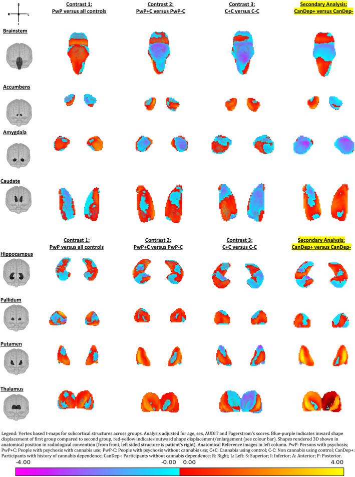 Vertex based t‐maps for subcortical structures across groups. Analysis adjusted for age, sex, AUDIT, and Fagerstrom's scores. Blue‐purple indicates inward shape displacement of first group compared to second group, red‐yellow indicates outward shape displacement/enlargement (see colour bar). Shapes rendered 3D shown in anatomical position in radiological convention (from front, left sided structure is patient's right). Anatomical Reference images in left column: A, anterior; I, inferior; L, left; P, posterior; R, right; S, superior