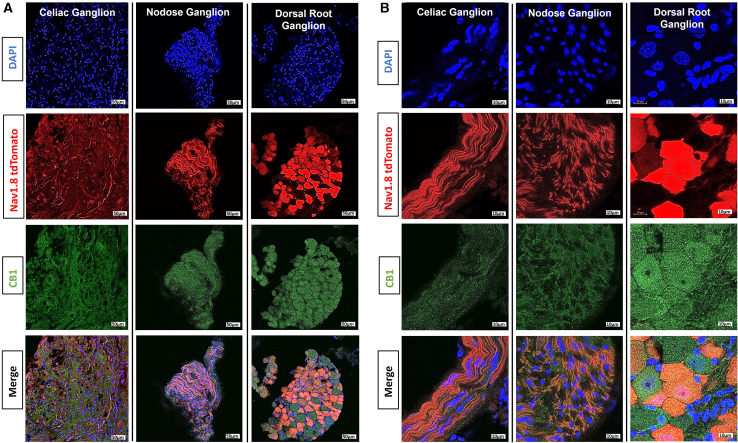 Localization of CB1 receptor within afferent/sensory neuronsCB1 immunostaining of cross-sections of the celiac ganglion, nodose ganglion, and thoracic (T10) dorsal root ganglion of Nav.1.8-tdTomato mice (CB1 = green, Nav1.8-tdTomato = red, DAPI = blue.(A) 20×; scale bars, 50 μm and (B) 100×; scale bars, 10 μm. n = 4–5 mice.