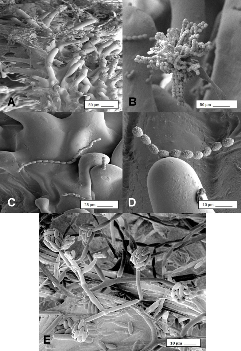 Scanning electron microscopic images of the development of mycelium and spore production by Penicillium olsonii on inoculated cannabis inflorescences. (A) Spores and mycelium on stigmatic hairs (papillae). (B) Conidiophore with chains of conidia characteristic of Penicillium formed on the bud surface. (C, D) Close-up views of spore chains of P. olsonii stuck to stigmatic hairs. (E) Conidiophore and conidia of Fusarium oxysporum on inoculated flower bud.
