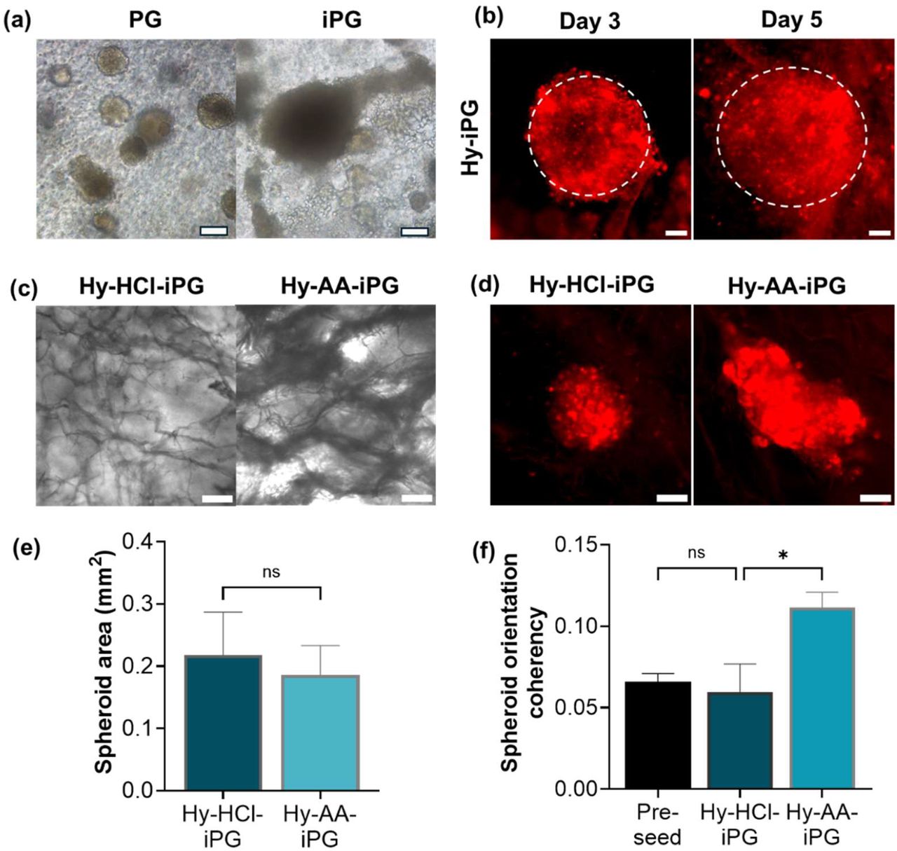 Independent control over hybrid scaffold fibre structure guides primary breast cancer invasion.(a) Peptide gels modified with invasion-promoting ECM additions (iPG) promote increased growth and invasion relative to unmodified peptide gels (PG); (b) Spheroid invasion within hybrid scaffolds incorporating iPG (Hy-iPG) may be tracked over time using CellTrackerTM dye; (c) Fibre morphology in the hybrid scaffolds is controlled via choice of solute during scaffold ice templating (Hy-HCl-iPG: hybrid scaffold incorporating iPG and scaffold templated with HCl; Hy-AA-iPG: hybrid scaffold incorporating iPG and scaffold templated with acetic acid); (d) Control over fibre morphology controls the directionality of spheroid invasion, with Hy-AA-iPG inducing directed invasion along collagen fibres. Quantification of (e) spheroid size and (f) orientation coherency demonstrates significantly higher orientation coherency at constant spheroid size induced by the Hy-AA-iPG hybrid scaffold relative to Hy-HCl-iPG. Plots show mean and standard error of day 5 measurements from n=3 patients; * indicates p<0.05. All scale bars 100 µm.