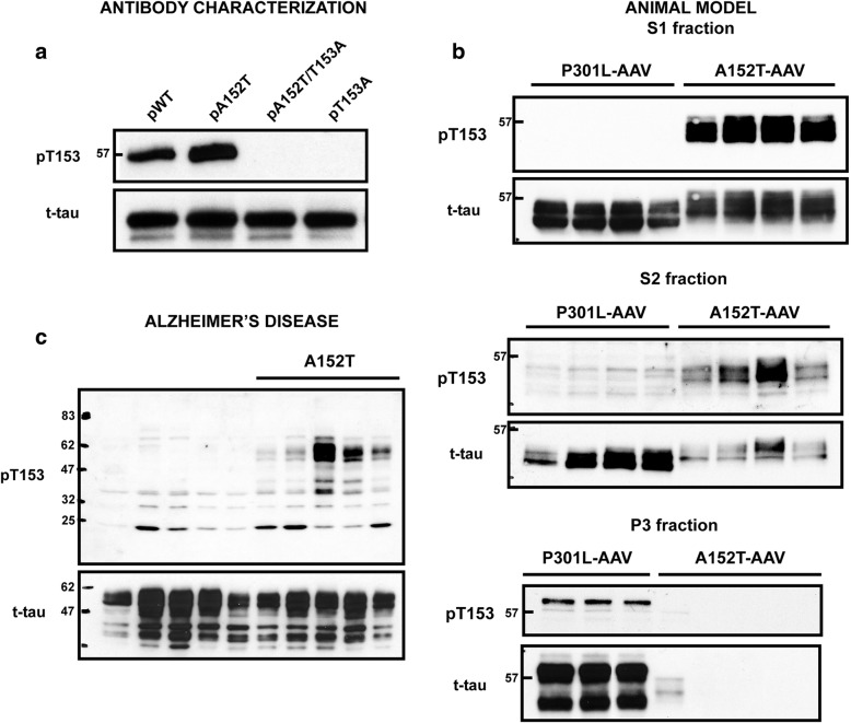 Accumulation of soluble pT153 is specific to A152T carriers. a Recombinant wild-type (WT) and mutant tau proteins (including A152T, A152T/T153A, and T153A) were phosphorylated in vitro with GSK3β, and subsequently evaluated by immunoblotting. 100 ng of each recombinant phosphorylated protein was loaded, followed by detection with phospho-specific antibody (pT153) and E1 (human-tau specific antibody) to confirm equal protein loading. b Biochemical fractionation followed by immunoblotting reveals significant accumulation of pT153 in the S1 and S2 soluble fractions in A152T-AAV mice, while pT153-positive tau is detected in the P3 fraction in P301L-AAV mice. c The amount of pT153 and total tau in the soluble S1 fraction from frontal cortex of A152T carriers and noncarriers with Alzheimer’s disease (AD) was evaluated by immunoblotting