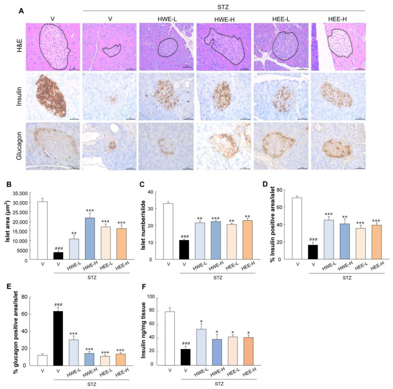 Protective effects of hemp root extracts against islet dysfunction. (A) H&E and DAB staining for insulin and glucagon were performed to analyze histopathological changes in pancreatic islets. H&E-stained sections were analyzed for measurements of (B) islet area and (C) islet number using ImageJ software (Version 1.8.0). Quantitative data relating to (D) insulin and (E) glucagon signals were calculated by dividing the area of target signal by the total islet area, for at least 10 islets per mouse. (F) The pancreatic insulin content was measured by an ELISA kit. V, vehicle; HWE-L, hemp root water extract at low dose; HWE-H, hemp root water extract at high dose; HEE-L, hemp root ethanol extract at low dose; HEE-H, hemp root ethanol extract at high dose. Data are shown as means ± SEM (n = 4 for (B–E) and n = 6 for (F)). ### p < 0.001 vs. non-STZ vehicle group; * p < 0.05, ** p < 0.01, *** p < 0.001 vs. STZ-vehicle group.
