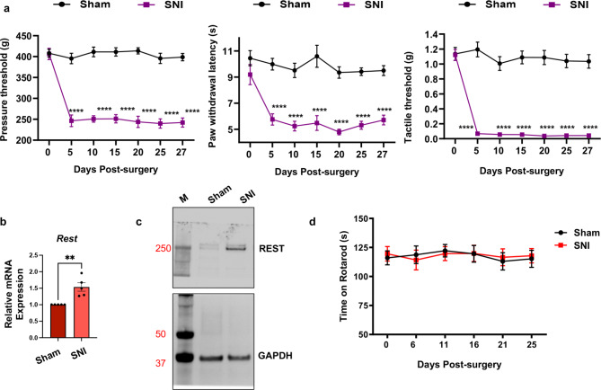 (a) Peripheral nerve injury induces chronic neuropathic pain hypersensitivities in wild-type mice. Either spared nerve injury (SNI) or sham surgery (Sham) was performed on the left hind limbs of male wild-type mice. Pain symptoms, in terms of ipsilateral hindpaw withdrawal thresholds (withdrawal latency), were determined in response to a noxious pressure stimulus (mechanical hyperalgesia), noxious radiant heat (thermal hyperalgesia), and von Frey filaments (tactile allodynia) over 27 days (Days post-surgery). N = 6 per group. A Student’s t-test was used. P-values are shown (* <0.05; **<0.01; ***<0.001; ****<0.0001) compared with sham group. Data are presented as mean ± SEM. (b–d) SNI results in increased mRNA and protein levels of the REST gene in the injured DRG of wild-type mice, but it does not cause significant changes in the rotarod assays. (b) mRNA samples from the L3/L4 DRG tissues of mice, characterized in Fig. 1a, were used for RT-qPCR analysis of Rest transcripts. Gapdh was used as an internal control. A Student’s t-test was used to measure the p-value. N = 5 mice per group. Data are presented as mean ± SEM. (c) Western blotting assays from the L3/L4 DRG tissues indicated a corresponding increase in the REST protein. M = Molecular weight ladder. Approximate molecular weights in kilodalton are also shown. (d) Rotarod assays of wild-type mice indicate no significant difference between sham and SNI treatment.