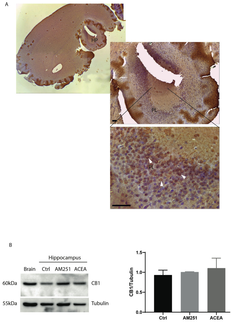 Expression CB1 receptors in hippocampus (HP). (A) Parasagittal hippocampal section of 5 μm from one-month-old mice stained with anti-CB1 antibody. General view of CB1-immunoreactivity on hippocampus. The bottom panel shows the highest magnification of the pyramidal layer of a parasagittal section of ventral hippocampus (magnification 40×, scale bar 25 µm). PL: Pyramidal cell layer. CB1-positive cells are indicated by arrowheads. (B) Western blotting with anti-CB1 antibody on protein extracts from hippocampal slices treated for 6 h with ACEA (10 μM) or AM251 (10 μM). Whole brain is used as CB1-positive control. On the right, histograms reporting the densitometric analysis (Image J-win64). Tubulin is used as reference for protein loading. Results were obtained from n = 3 independent experiments. Error bars represent SD. Columns were compared with an unpaired t-test. No statistical differences were observed.