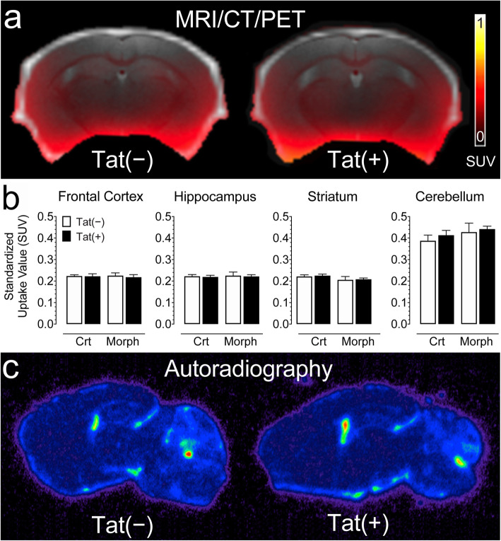 No significant changes were noted for neuroinflammation assessed by in vivo PET imaging using the [18F]-PRB111 probe in Tat transgenic mice in the presence or absence of morphine treatment. a A representative overlay image of a Tat(−) and Tat(+) mice show MR (gray), CT (white), and PET (SUV scale, yellow-red) imaging in the coronal plane. b PET imaging of Tat transgenic mice demonstrates the successful uptake of the [18F]-PBR111 radiotracer in different brain regions. No significant effect was noted for drug and/or genotype. c A representative brain image of a Tat(−) and Tat(+) mouse shows similar distribution of [18F]-PBR111 binding via post-mortem autoradiography in both groups in the parasagittal plane approximately 2 mm from the midline. All data are expressed as mean ± SEM. Statistical significance was assessed by ANOVA followed by Tukey’s post hoc test. SUV standardized uptake value, Crt no injections, Morph short-term (8-day) morphine injections. n = 5–7 mice per group