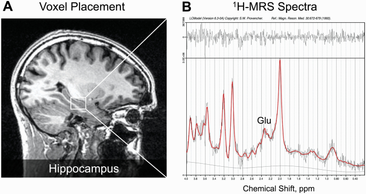Illustrative example of 1H-MRS voxel positioning and spectra in left hippocampus. In panel (A), example voxel placement in the left hippocampus is indicated by the box. Panel (B) shows the 1H-MRS spectrum obtained (black line) from the voxel in A and the overlay of the spectral fit (red line). Glu indicates glutamate and ppm, parts per million.