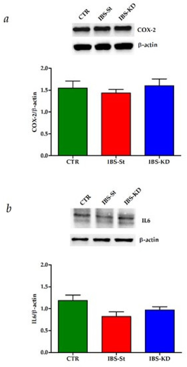 (a) COX-2 protein expression levels and representative blots detected in the control group (CTR), IBS rats fed a standard diet (IBS-St), and IBS rats treated with low-carbohydrate, high-fat ketogenic diet (IBS-KD). (b) IL-6 protein expression levels and representative blots detected in the control group (CTR), IBS rats fed a standard diet (IBS-St), and IBS rats treated with low-carbohydrate, high-fat ketogenic diet (IBS-KD). All data represent the results of three different experiments (mean ± SD). p-value was determined by ANOVA Tukey’s multiple comparison test.