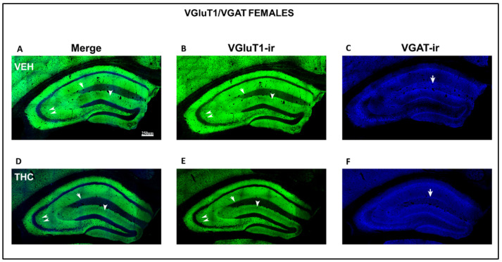 Low-magnification confocal images showing aberrant VGluT1-ir and VGAT-ir in female pups. Confocal photomicrograph collages showing VGluT1-ir (green labeling; B,E), VGAT-ir (blue labeling; C,F), and merged images (A,D) in the HIPP of VEH (A–C) and THC (D–F) female pups at P60. Observe the decreased VGluT1-ir in the DG distal-inner molecular layer (arrowhead in D,E), in the CA3 strata lucidum (double arrow in D,E) and radiatum, and in the CA1 stratum lacunosum-moleculare (arrows in D,E) in THC mice compared to that in VEH pups. These data show that the primary trisynaptic loop in THC female pups is irregular. A band of decreased VGAT-ir boutons at the lacunose-molecular layers of CA1 in THC pups is indicated (arrow in C,F)—the same scale for (A–F).