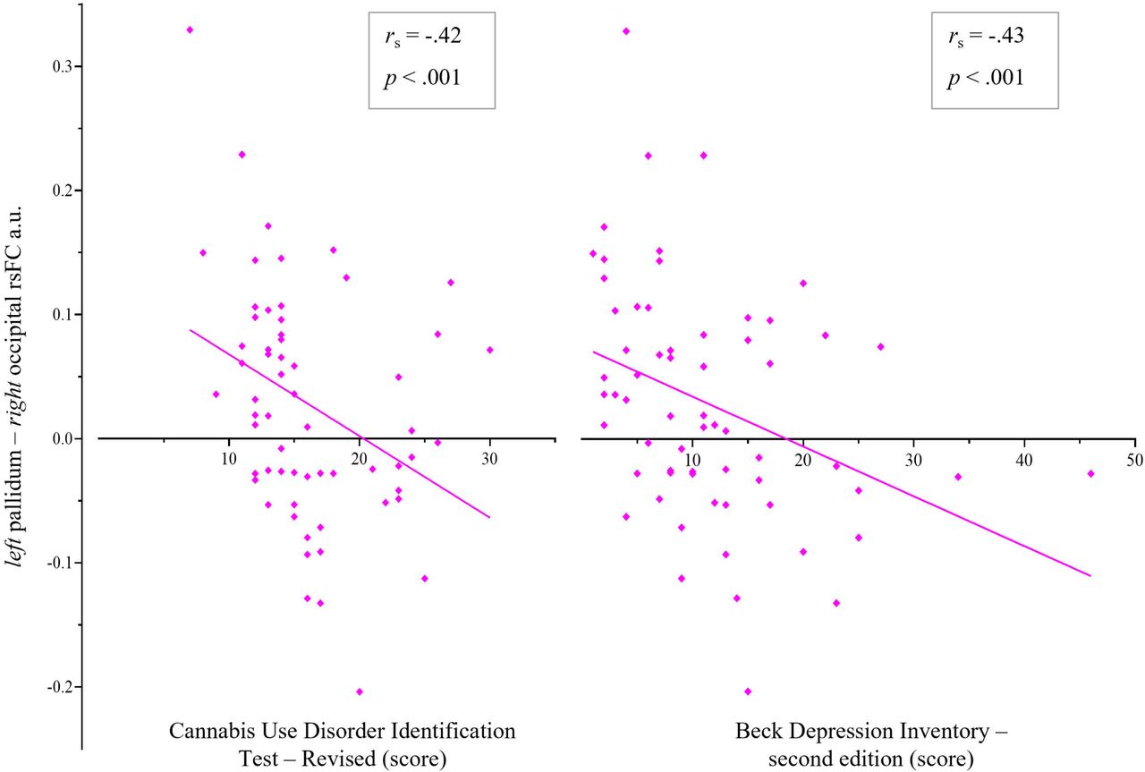 Spearman’s rho (rs) correlations within the CUD group, between rsFC pairs showing group differences (rsFC beta values) significantly correlated with metrics of cannabis exposure and related problems and depression scores, using Bonferroni adjusted alpha threshold of p < .001 (.05 ÷ 45)
