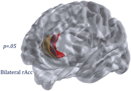Region displaying group differences: bilateral rostral anterior cingulate.