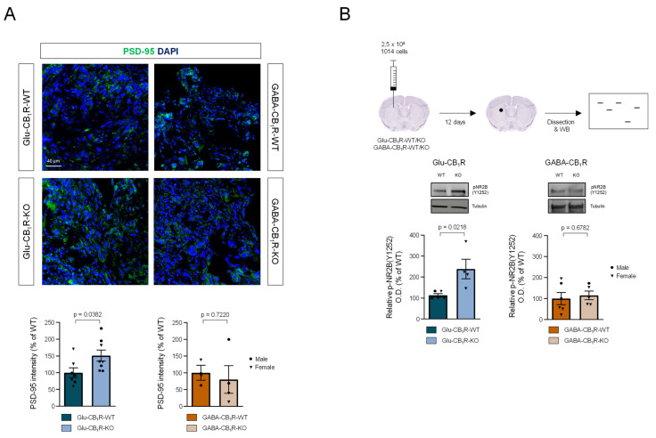 Glutamatergic-neuron CB1Rs influence NMDAR-associated signalling in melanoma cells in the brain. (A). PSD-95 immunoreactivity in tumour brain slices. Representative images are shown on the top, and dot plots showing quantifications (immunofluorescence intensity relative to total cell nuclei) are shown on the bottom. Comparisons were made by unpaired Student’s t test. (B). Glu-CB1R-KO, GABA-CB1R-KO, and control littermates of both sexes were intracranially injected with 25,000 1014 cells in the dorsal striatum and 12 days later, tumours were dissected and subjected to Western blot (WB) analysis to detect phosphorylated (active) NMDAR2B. Representative blot images and relative optical density (O.D.) quantification are shown. Circles: male mice; triangles: female mice. Comparisons were made by unpaired Student’s t test.