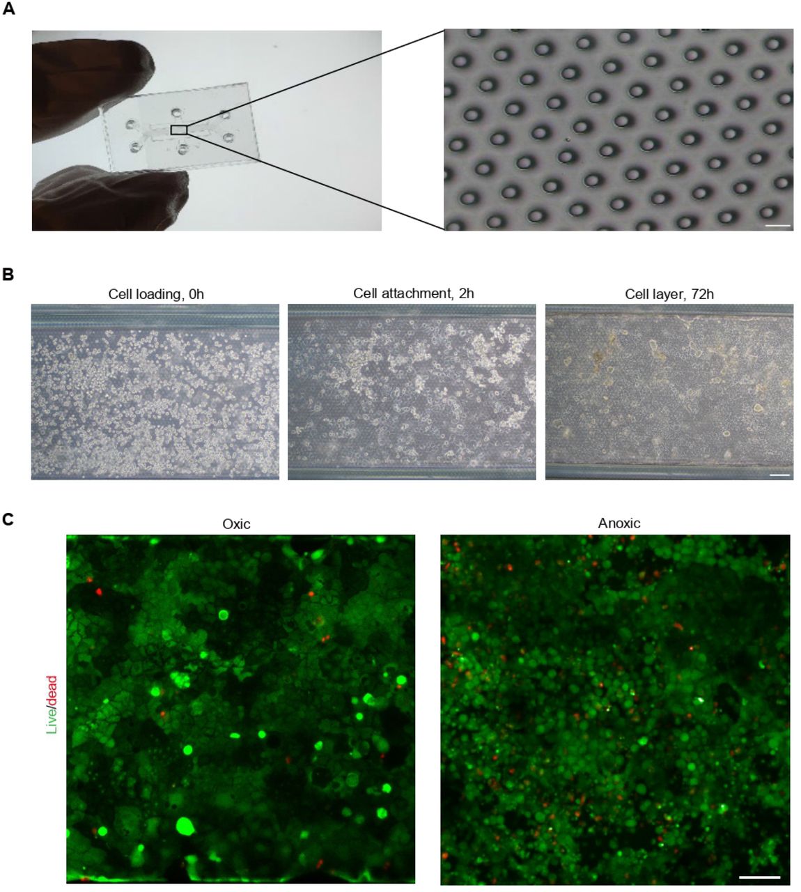 Characterization of the GOC device and on-chip cell culture. (A) Photograph of the fabricated GOC device (left) and a micrograph of its porous membrane (right). Scale bar: 20 µm. (B) Brightfield images depicted the endothelial cell layer formation procedure in the GOC. Scale bar: 100 µm. (C) Fluorescence images from a Live/Dead assay under normoxic and anaerobic conditions. Live and dead cells were stained green and red, respectively. Scale bar: 100 µm.