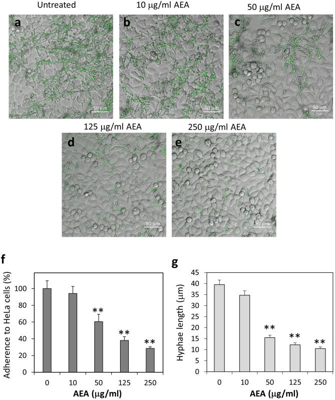 AEA treatment of C. albicans reduced their adherence to HeLa cervical epithelial cells. (a–e) Confocal microscopy of co-cultures of control and AEA-treated C. albicans on confluent HeLa cells. The fungi were pretreated with the indicated concentrations of AEA for 1 h prior to co-incubation with HeLa cells for an additional 1 h. The fungi express GFP. (f) Quantification of the relative adherence of untreated and AEA-treated C. albicans to HeLa cells. 8–10 images taken from 3 independent experiments were analyzed for each treatment. (g) The average hyphae lengths of untreated and AEA-treated C. albicans that were able to adhere to HeLa cells. The number of hyphae measured for each treatment was 50–75. **p < 0.001.
