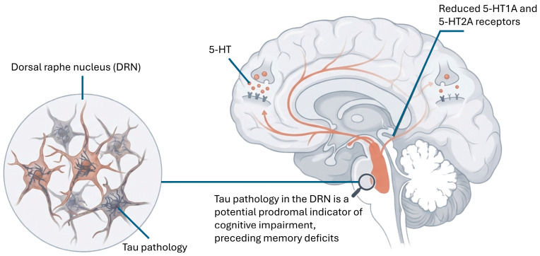 Dorsal raphe nucleus (DRN) serotonergic neuron degeneration and early tau involvement, positioning serotonergic disruption as a prodromal contributor to neuropsychiatric symptoms (depression, sleep disturbance, agitation) and subsequent cognitive decline. Reduced serotonergic receptor availability (including 5-HT1A/5-HT2A-related signaling changes) and diminished serotonergic release are shown to alter cortical/hippocampal plasticity, mood-regulating circuitry, and potentially Aβ/tau biology through downstream neuromodulatory pathways. Tau pathology in the DRN is positioned as a potential prodromal indicator of cognitive impairment, preceding memory deficits.