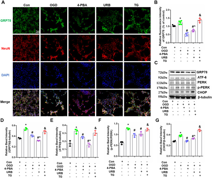 Effects of URB597, 4-PBA, and TG on HT22 cell ER stress in OGD. A Representative GRP78 (green) and NeuN (red) immunofluorescence. B Statistical analysis of the fluorescence intensity of GRP78. C The expression of ER stress signaling-related proteins, including GRP78, ATF-6, p-PERK/PERK, and CHOP. D–G Expression histograms. ∗p < 0.05 νs. Con, #p < 0.05 νs. OGD, ^p < 0.05 νs. 4-PBA, &p < 0.05 νs. URB597, (n = 3)