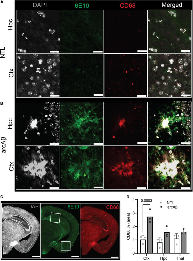 Microgliosis in the 17-month-old arcAβ mouse brain. (A–C) Brain tissue sections of non-transgenic littermate (NTL, n = 3) and arcAβ mice (n = 3) were stained for 6E10 (green)/CD68 (red) in the hippocampus (Hpc) and cortex (Ctx). White boxes in panel (C) indicate the regions including cortex (Ctx), cornu ammonus 1 (CA1) region of the hippocampus (Hpc) that zoomed-in in panels (A,B). Nuclei were counterstained with DAPI (white). Scale bar = 20 μm (A,B), =1 mm (C). (D) Quantification of CD68 signals in the Hpc, Ctx, and thalamus (Thal) of arcAβ mice compared to NTL mice confirmed microgliosis in arcAβ mice.