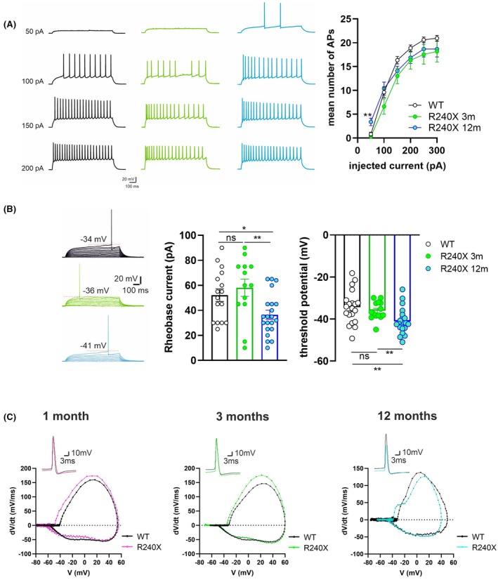 Time‐dependent alterations in intrinsic excitability and action potential dynamics of dentate granule cells in R240X mice. (A) Patterns of action potential (AP) firing in WT (black) and Epm2a R240X mice at 3 (green) and 12 (cyan) months. The plot representing the mean number of AP shows a significant difference in the firing pattern discharge elicited by the first step of depolarizing current injected between WT and 12‐month‐old Epm2a R240X mice (WT: .61 ± .4, n = 15; 3m‐R240X: .3 ± .1, n = 13, p = .27 vs WT; 12m‐R240X: 1.9 ± .8, n = 10, p = .0088 vs WT; unpaired Student's t test with Welch's correction). (B) Current–clamp recordings (5 pA–stepped depolarizing current injections; 1 s), scaled to show AP threshold (red dotted line), in WT (black) and Epm2a R240X mice at 3 (green) and 12 (cyan) months. Bar graphs showing a significant reduction of the rheobase current (middle, WT: 52.19 ± 5.04 pA, n = 16; 3m‐R240X: 58.08 ± 6.8 pA, n = 13, p = .48 vs WT; 12m‐R240X: 36.48 ± 3.6 pA; n = 21, p = .013 vs WT; p = .0045 3m‐R240X vs 12m‐R240X; unpaired Student's t test with Welch's correction) and a hyperpolarized threshold potential (right, WT: −34.4 ± 1.76 mV, n = 20; 3m‐R240X: −36.02 ± 1.14 mV, n = 14, p = .49 vs WT; 12m‐R240X: −41.16 ± 1.33 mV; n = 21, p = .0037 vs WT; p = .0098 3m‐R240X vs 12m‐R240X; unpaired Student's t test with Welch's correction) in 12‐month‐old Epm2a R240X. Values are reported as mean ± SEM; circles in bar graphs represent individual cells. *p < .05, **p < .01. (C) Phase–plane analysis of action potentials in dentate granule cells from WT and R240X mice at different ages. Representative phase–plane plots (dV/dt vs membrane potential) are shown for neurons recorded at 1 month (left, WT in black, Epm2a R240X in magenta), 3 months (middle, WT in black, Epm2a R240X in green), and 12 months (right, WT in black, Epm2a R240X in blue). Insets illustrate representative single action potential waveforms recorded in current‐clamp configuration under each condition (calibration: 10 mV, 3 ms).