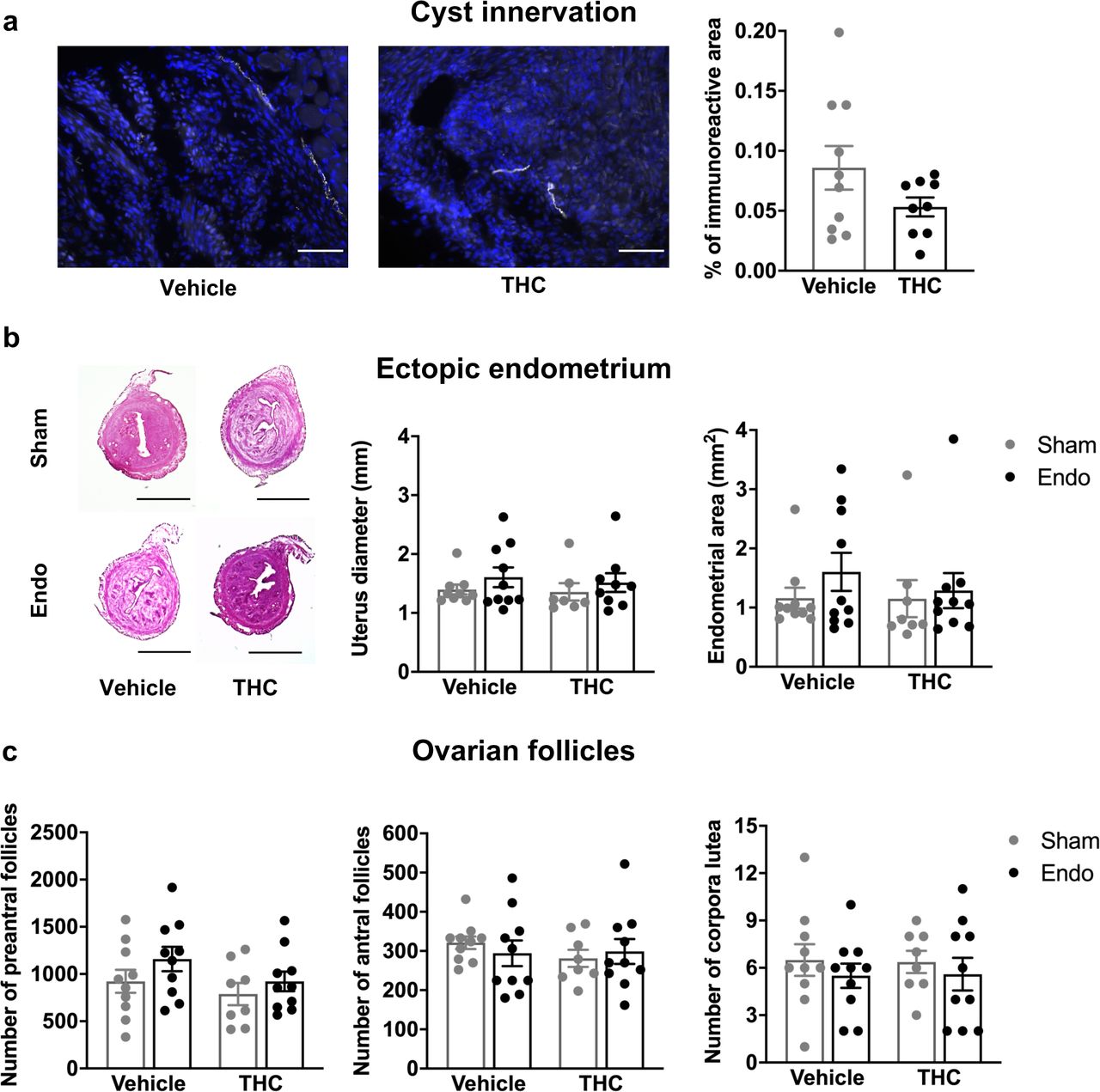 Histological features of reproductive tissues after chronic THC treatment.(a) Cyst innervation was unaffected by THC. Blue is DAPI and white is β-III tubulin. Scale bar = 100 μm. (b) Uterine diameter and area of endometrial tissue were similar among the groups. Scale bar = 1 mm. (c) Number of preantral follicles, antral follicles and corpora lutea were unchanged after THC. Error bars are mean ± SEM. Student t-test (a) and two-way ANOVA (b and c). Endo, endometriosis; THC, Δ9-tetrahydrocannabinol. Figure 4 - Source Data.
