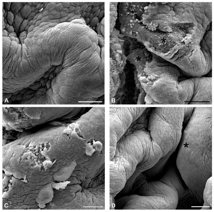Representative SEM micrographs of the urothelium in urinary bladders from all experimental groups of mice. (A) The luminal surface of the urothelium in the control mouse consists of highly differentiated polygonal superficial cells with a typically scalloped apical plasma membrane and well-defined borders between them due to numerous tight junctions. (B) Extensive and deep injuries (asterisks) with urothelial cell desquamation extending to the basal lamina in the urothelium of the CYP-treated mouse. (C) Small and shallow injuries extending to the basal cell layer in the urothelium of the CYP + veh-treated mouse. (D) The luminal surface of the urothelium is intact, with an area of small and less differentiated superficial cells (asterisk) due to local renewal in the CYP + CBD-treated mouse. Scale bars: (A–D) 100 µm.