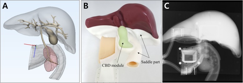 3D modeling and fabrication of ERCP training simulator. a 3D model parts; b Fabricated 3D phantoms. ‘CBD module’ refers to a removable ampullary and common bile duct part. The ERCP phantom is fixed with a supporting stand and positioned to the prone position; c Fluoroscopic image of the phantoms