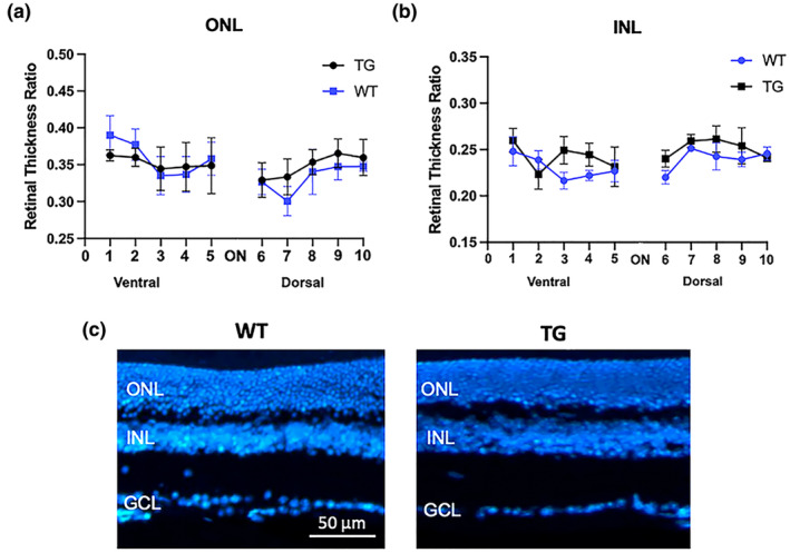 Retinal thickness. Analysis of ONL (a) and INL (b) thickness from ventral to dorsal direction on retinal cryosections crossing the optic nerve (ON). (c) Representative fluorescence images of WT and TG retinal cryosections stained with bisbenzimide nuclear dye (blue). Measurements are expressed as the ratio of ONL/total retina thickness and INL/total retinal thickness calculated along the vertical meridian. Scale bar: 50 μm. Data are shown as mean ± SEM (n = 4–5). For abbreviations see the abbreviations list. Details of the statistical analyses are reported in Table S1.