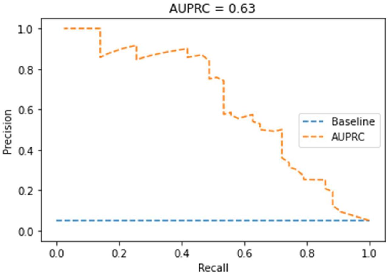 Precision-Recall curve of the random forest model.