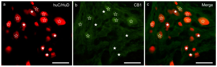 CB1 receptor immunoreactivity in the myenteric plexus of the pig ileum: (a) HuC/HuD immunoreactive neurons, (b) CB1 receptor immunoreactivity, (c) merge image. The open stars indicate HuC/HuD immunoreactive neurons co-expressing weak-to-moderate CB1 receptor immunoreactivity. The white stars indicate HuC/HuD immunoreactive neurons, which were CB1 negative. Scale bar: 50 µm.