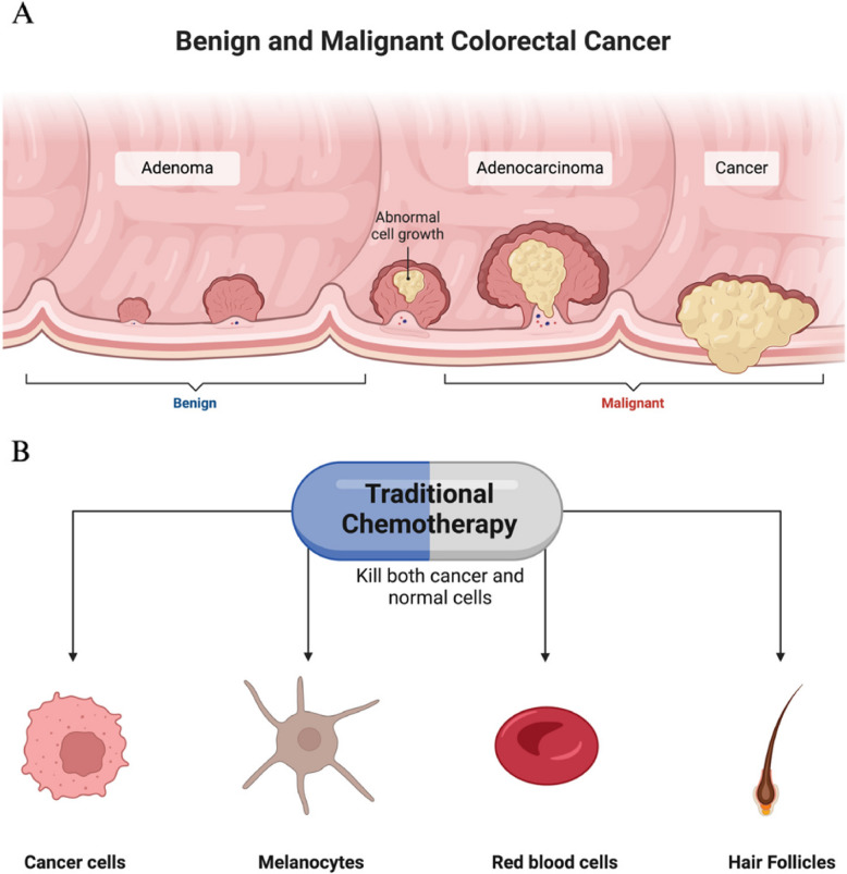 A Progression of colorectal cancer from benign to malignant stages. This illustration shows the development of colorectal cancer, beginning with benign growths (adenomas) that can, over time, progress to adenocarcinoma and eventually to malignant cancer. B Non-selective targeting of chemotherapy on cancer and healthy cells. This illustration highlights the limitations of traditional chemotherapy, which affects not only cancer cells but also healthy cells such as melanocytes, red blood cells, and hair follicles. This lack of specificity contributes to the adverse side effects associated with chemotherapy, highlighting the need for more targeted therapeutic approaches in oncology