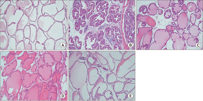 H&E staining of prostate tissues from different groups of rats (magnification ×100): (A) Staining of healthy controls showed no inflamed cell infiltration or proliferation of fibrous tissue. The prostatic glandular epithelial cells and glandular epithelial tissue of pseudo hyperplasia remained regularly arranged. No glandular hyperplasia was observed in the ductal lumen. (B) In the chronic prostatitis/chronic pelvic pain syndrome group, proliferation of fibrous tissue can be seen in the intercellular structure, along with infiltration of inflammatory cells, disorganization of the epithelial cell layer of the prostate, and a large number of tumor-like epithelial hyperplasia protruding into the lumen of the ducts. (C–E) In cannabidiol treatment groups at doses of 50, 100, and 150 mg/kg, respectively, tumor-like epithelial hyperplasia in the ductal lumen was significantly reduced and prostate glandular epithelia were regularly aligned; this effect was more pronounced at higher doses.