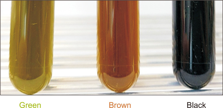 Classification of bile pigments in the bile of patients with CBD stones and BTC. The three bile pigment colors.