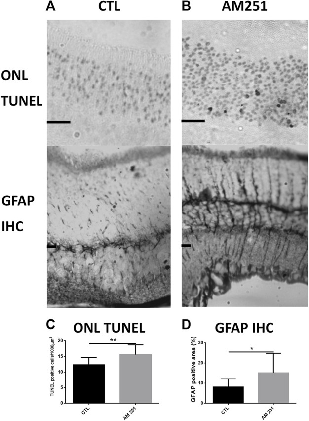 Treatment with AM251 increased the number of apoptotic nuclei and GFAP-immunoreactive areas. (A): Representative TUNEL stained sections of the outer nuclear layer (ONL) of the retina of a CTL eye (Left) and an AM251-treated eye (Right). Observe the higher amount of apoptotic nuclei in the AM251-treated eye compared to the CTL eye. Scale bar: 20 μm. (B): GFAP immunostained retinal sections of a CTL eye (Left) and an AM251-treated eye. A greater immunoreactivity of Müller cells is observed in the retina of the AM251-treated eye compared to the CTL eye. (C): Quantification of ONL TUNEL positive cells. (D) Quantification of positive GFAP immunostained area. *p < 0.05; **p < 0.01.