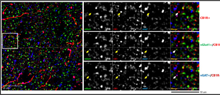 Representative micrograph of immunohistochemical labeling of postmortem human prefrontal cortex tissue section. Left panels: Puncta with vGlut1-immunoreactive (IR) (green), vGAT-IR (blue) & CB1R-IR (red) labeling are distributed throughout the image field. Right panels: Enlarged images with arrows identifying puncta with antibody immunoreactivity toward a single or multiple proteins.