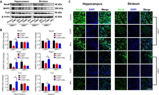 Effects of Cur/SLNs-HU-211 on the expression levels of neuronal markers in CBR1+/+ and CBR1–/– MDD model mice.(A) Western blot images showing the NeuN, MAP2, and Tuj1 levels in the hippocampus and striatum. (B) Quantitative reverse transcription-polymerase chain reaction analysis of NeuN, MAP2, and Tuj1 mRNA levels in the hippocampus and striatum. mRNA expression levels were normalized against GAPDH expression levels in the CBR1+/+ control group. Data are presented as the mean ± SD (n = 3/group). *P < 0.05 (one-way analysis of variance, followed by the least significant difference test). (C) Representative immunofluorescence images of NeuN-positive cells (green, stained by Alexa Fluor® 488), in the hippocampus and striatum. Scale bar: 100 µm. CBR1–/–: Cannabinoid receptor 1 knockout; CBR1+/+: wild-type; CORT: corticosterone; Cur/SLNs-HU-211: solid-lipid nanoparticles loaded with curcumin and dexanabinol; DAPI: 4′,6-diamidino-2-phenylindole; GAPDH: glyceraldehyde 3-phosphate dehydrogenase; MAP2: microtubule-associated protein 2; MDD: major depressive disorder; NPs: nanoparticles loaded with curcumin and dexanabinol (Cur/SLNs-HU-211); Tuj1: class III β-tubulin.