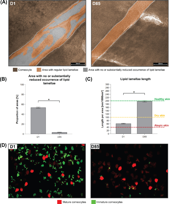 Analysis of lipid lamellae and corneocyte maturity. (A) Colored TEM picture of Lipbarvis® samples taken at baseline (D1) and after 12 weeks (D85), dark brown: corneocyte, orange/brown: areas with regular lipid lamellae, grey: areas with no or substantially reduced lipid lamellae. (B) Proportion of areas with no or substantially reduced lipid lamellae at baseline (D1) and after 12 weeks of test product(s) application (D85) as percentage of total intercellular area, n = 16, two-sided paired t-test, data represent mean±SEM, *p ≤ 0.05. (C) Length of intercellular lipid lamellae (nm/1,000 nm2) at baseline (D1) and after 12 weeks of test product(s) application (D85), n = 16, two-sided paired t-test, data represent mean±SEM, *p ≤ 0.05, indication of skin condition according to Dähnhardt et al. (8). (D) Microscope image of exemplary D-Squame® corneocyte samples (of 1 subject) post-staining at baseline (D1) and after 12 weeks of test product(s) application (D85), red: mature corneocytes, green: immature corneocytes.