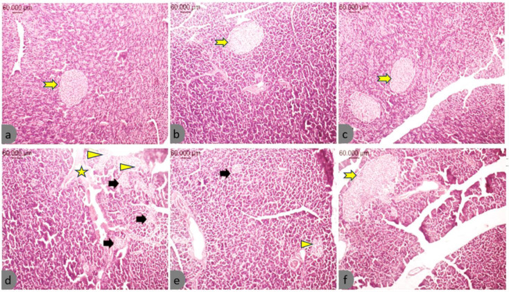 Histopathological findings of the pancreatic tissues in the different study groups. (a) NC-PBS, (b) NC-PB.t, (c) NC-B.t-EVs, (d) T2DM-PBS, (e) T2DM-PB.t, (f) T2DM-B.t-EVs; Pancreatic specimens were prepared and examined under a light microscope (Olympus SZX16, Japan) H&E stain;10X magnification. Normal islets (yellow arrow), islet atrophy (black arrow), destruction and vacuolization. (arrowhead), eosinophilic accumulations (star).Groups categories: NC-PBS (normal control rats gavaged with PBS); NC-B.t-EV (NC gavaged with Bacteroides thetaiotaomicron(B.t)'s Extracellular Vesicles); NC-PB.t (NC gavaged with Pasteurized B.t); T2DM-PBS (type 2 diabetes mellitus gavaged with PBS); T2DM-B.t-EV (T2DM rats gavaged with B.t-EV); T2DM-PB.t (T2DM rats gavaged with PB.t).