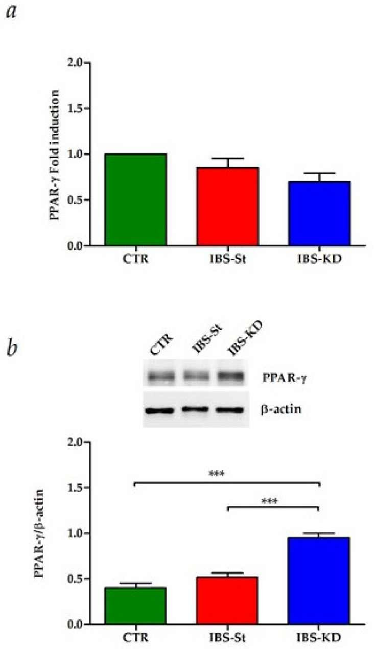 (a) Peroxisome proliferator-activated receptor-gamma (PPAR-γ) gene expression levels in the control group (CTR), IBS rats fed a standard diet (IBS-St), and IBS rats treated with low-carbohydrate, high-fat ketogenic diet (IBS-KD). (b) PPAR-γ protein expression levels, and representative blots in the control group (CTR), IBS rats fed a standard diet (IBS-St), and IBS rats treated with low-carbohydrate, high-fat ketogenic diet (IBS-KD). All data represent the results of three different experiments (mean ± SD); p-value was determined by ANOVA with Tukey’s multiple comparison test; *** p < 0.001.