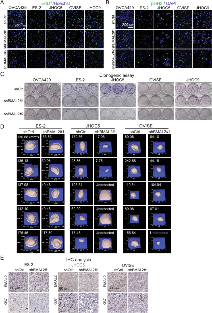 BMAL2 depletion inhibits tumorigenic ability in OCCC cells.(A) Representative EdU staining of OCCC cells without (shCtrl) or with BMAL2 depletion (shBMAL2#1 or #2). Scale bar indicates 100 µm. (B) Representative phospho-histone H3 (pHH3) staining of shCtrl and shBMAL2 OCCC cells. Scale bar indicates 200 µm. (C) Representative images of clonogenic assays in OCCC cells. (D) Individual 3D ultrasound tumor images from xenograft models in NUDE mice using shCtrl or shBMAL2 ES-2, JHOC5 and OVISE cells. Five mice were used for each group. The size of each tumor is indicated. (E) Representative images of BMAL2 and Ki67 IHC staining using serial tumor sections from ES-2, JHOC5 or OVISE derived tumors. Scale bars indicate 60 µm. Source data are available online for this figure.