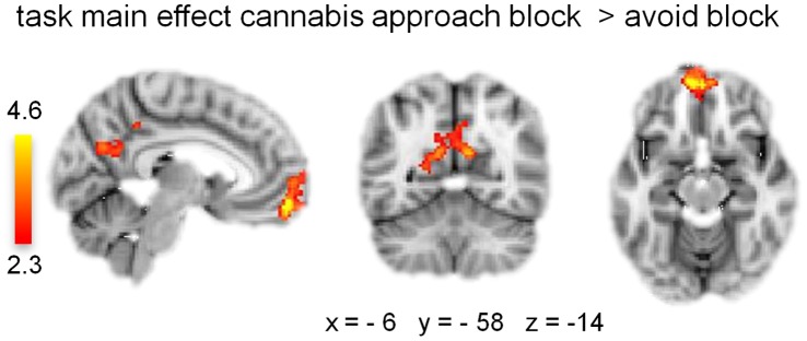 Main effect of approach vs. avoid blocks over groups.Clusters of significant activation in ventral medial frontal gyrus and posterior cingulate gyrus (Z >2.3, whole-brain cluster-corrected at p<0.05) are overlaid on a standard MNI brain. Right side of the brain is depicted at right side.